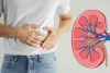 Over-the-Counter Danger: How Frequent Painkiller Use is Silently Destroying Your Kidneys