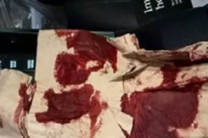 कश्मीरा शाह का खतरनाक एक्सीडेंट, शेयर की खून में लथपथ फोटो