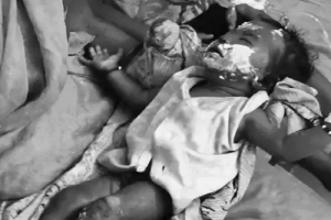 House Collapses Due to Cylinder Blast in Haryana, 11 Burnt: 7 Children Suffer 60% Burns, Pregnant Woman Critical; Explosion During LPG Refill